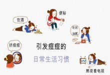 解析脸上长痘痘的具体原因，看过后你就懂了！